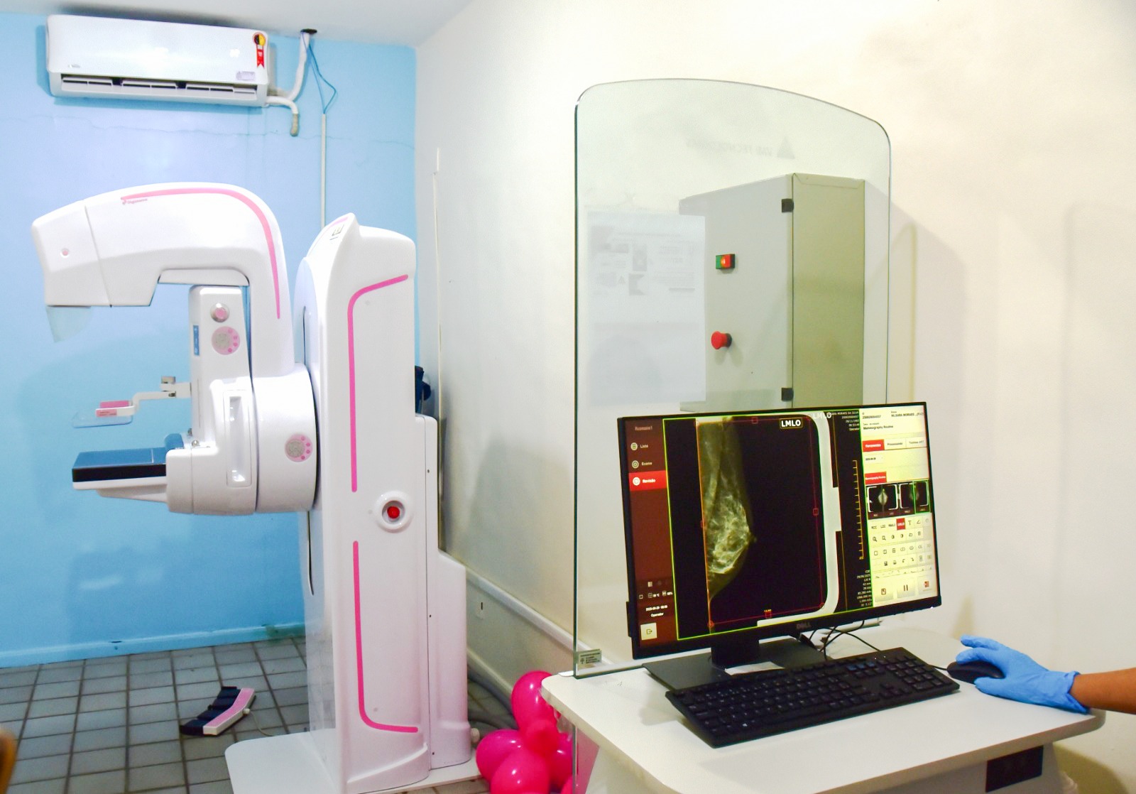 Ação Preventiva - TJRR Viabiliza 57 Mamografias em Parceria com a SESAU no Outubro Rosa